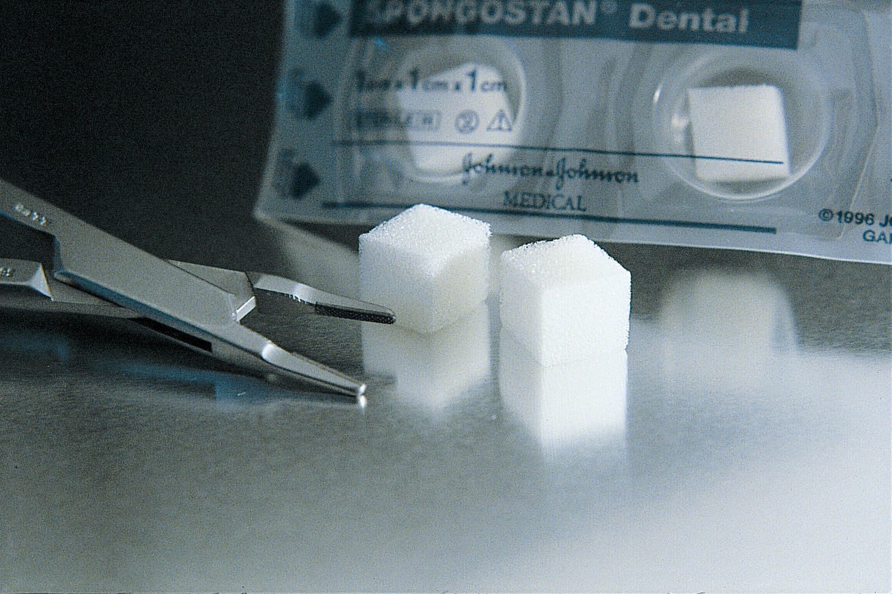 Spongostan Dental hemostatic. Buy it from Suture Online.